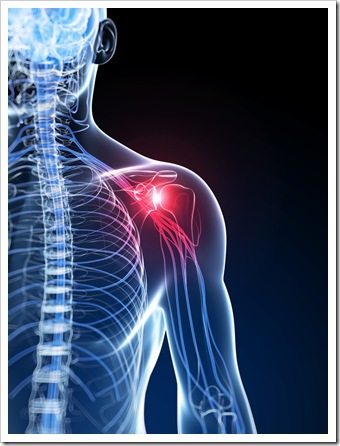 Shoulder Pain Sunnyvale CA Rotator Cuff Syndrome